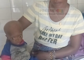 Malnutrition en Guinée: Le CNMSAN s’engage à renforcer ses capacités pour faire face à la situation