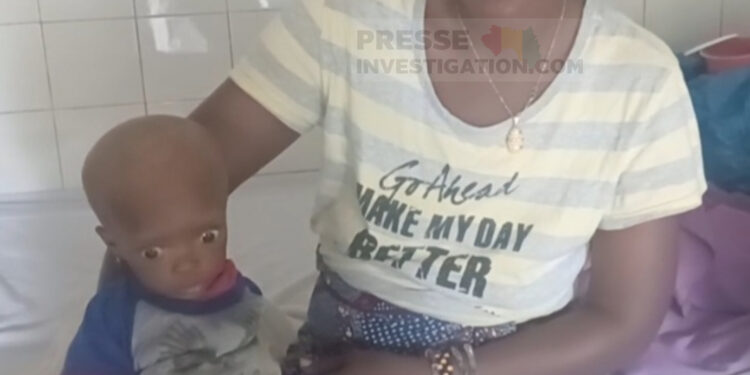 Malnutrition en Guinée: Le CNMSAN s’engage à renforcer ses capacités pour faire face à la situation